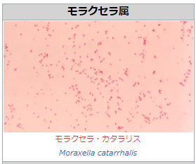 モラクセラ菌イメージ